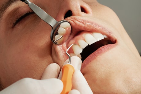 种植牙的7个步骤，为你详细解析种植过程